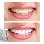 marvis-smokers-whitening-mint-toothpaste-85ml-f