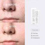 Dr.Althea-345-Relief-Cream-Daily-Face-Moisturizer-Blemish-Relief-Care